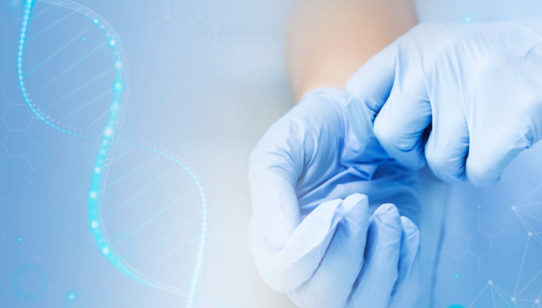 Gene Therapy for Alzheimer’s Disease
