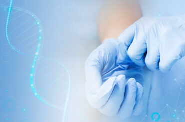 Gene Therapy for Alzheimer’s Disease